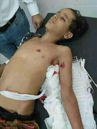 قناص حوثي يصيب طفل بجروح بليغة في تعز 