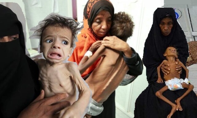 الأمم المتحدة : الوضع الإنساني في اليمن "يسقط من حافة هاوية"