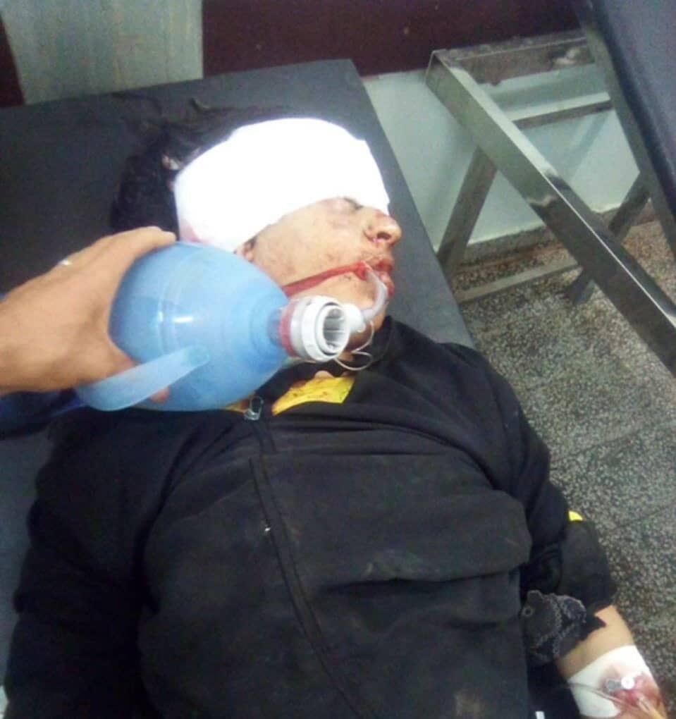 مليشيا الحوثي الانقلابية تقنص شابا في مقتبل العمر في البيضاء