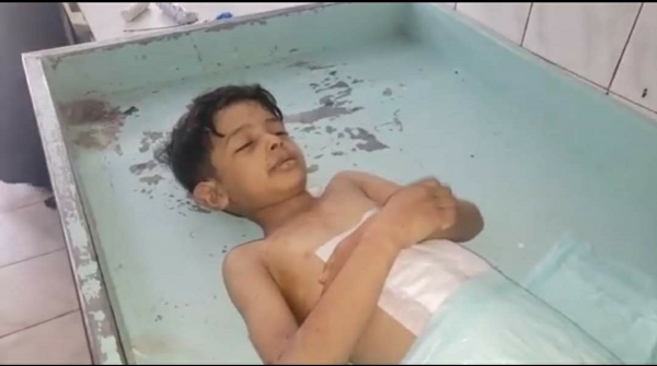 مقتل وإصابة 74 مدنيا بنيران الحوثيين في تعز منذ بدء "الهدنة الهشة"